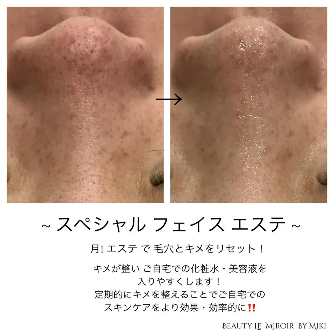 ビューティー ミロワールのエステ・リラクイメージ