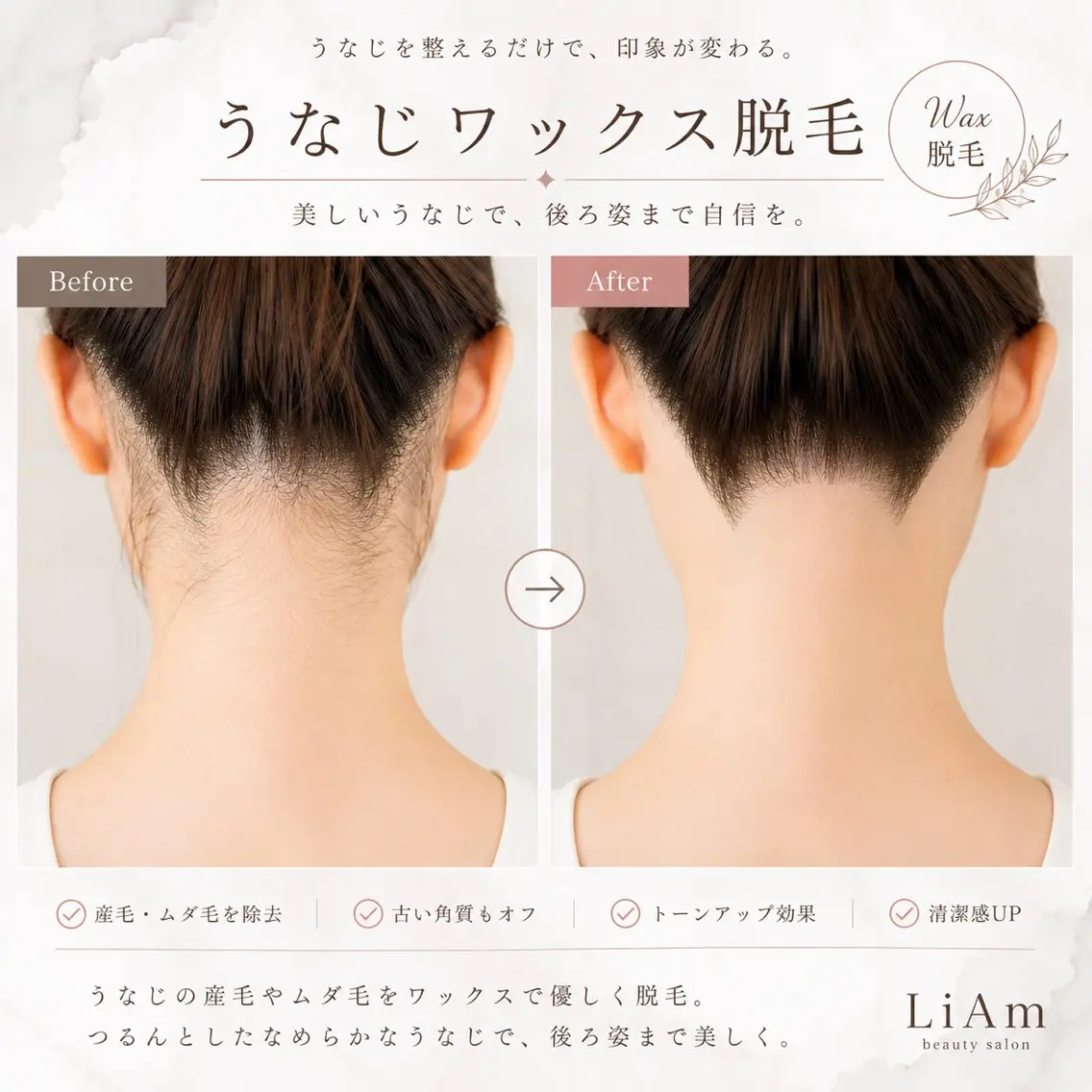脱毛 LiAm《韓国管理/ 小顔/脂肪ケア》のエステ・リラクイメージ