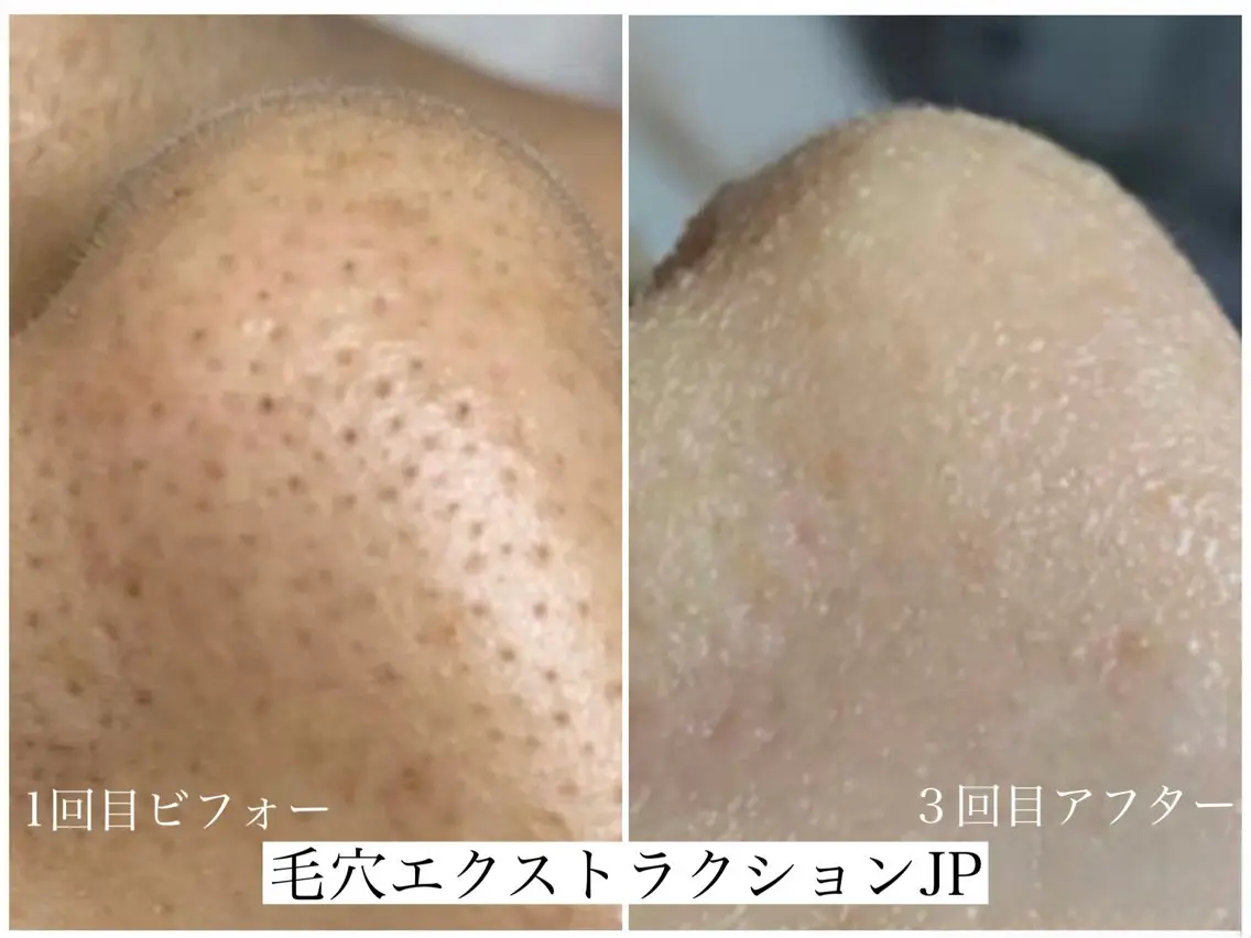 エステ 佐々木 風奈のエステ・リラクイメージ