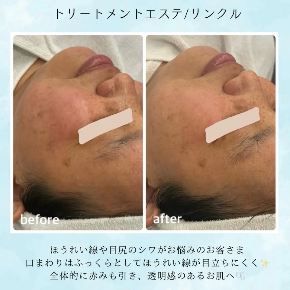 ナリス化粧品 Yumenaのエステ・リラクイメージ