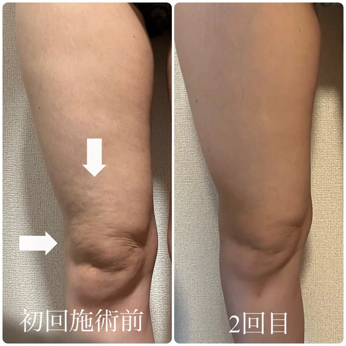 エステ リラク 木田 亜実のその他イメージ