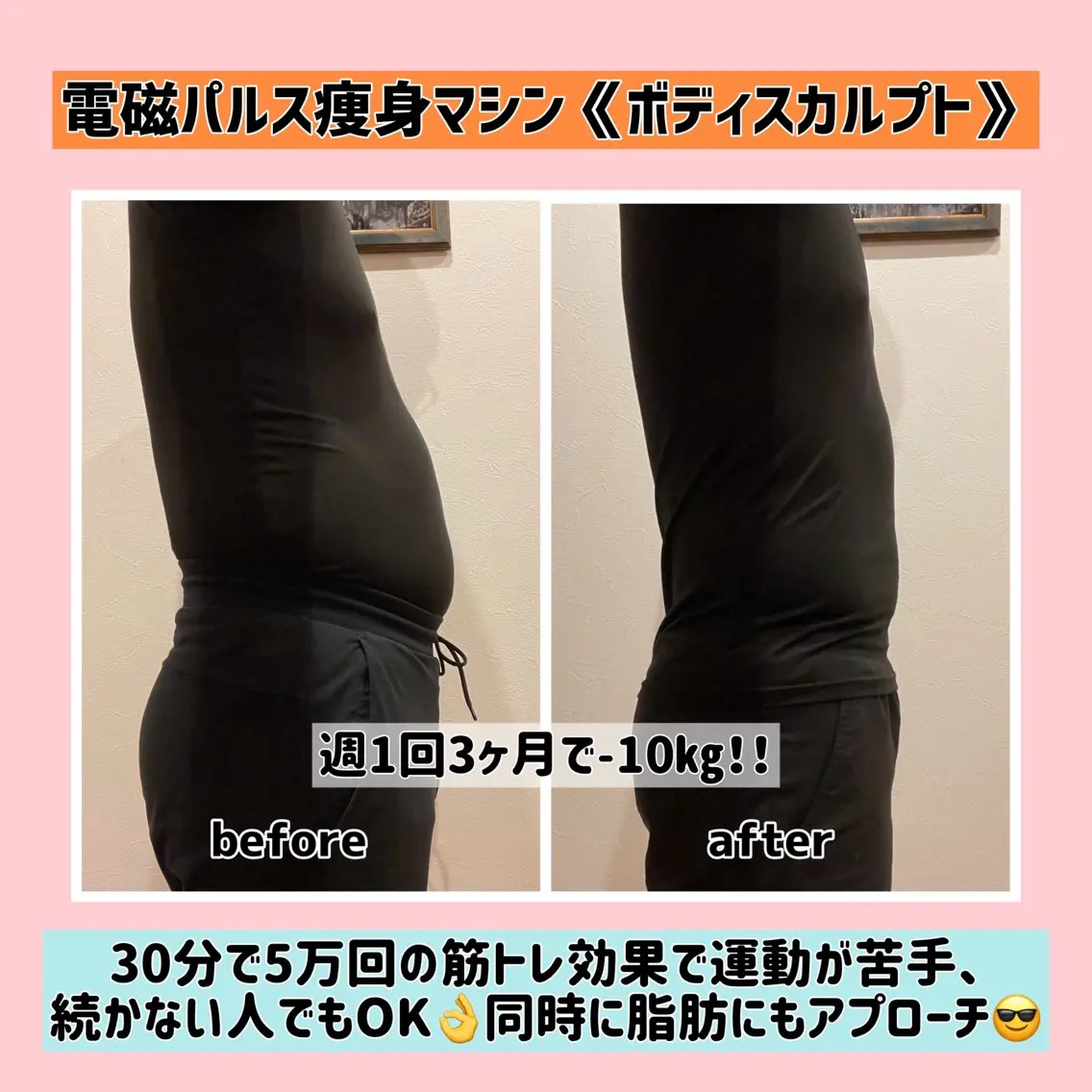 電磁パルス痩身マシン《ボディスカルプト》お試しの写真