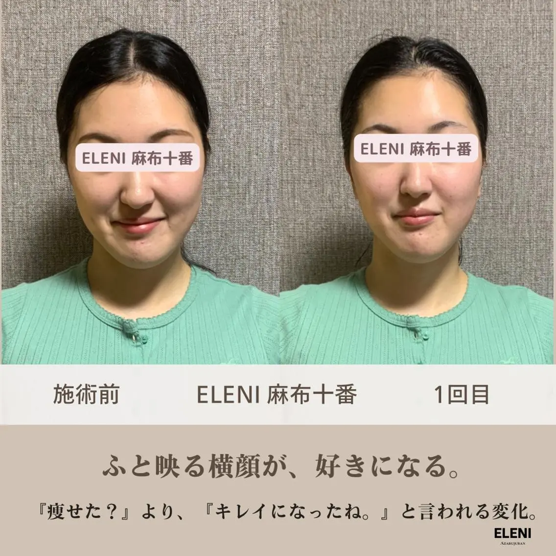 麻布十番小顔コルギ 姿勢矯正リアン💗のエステ・リラクイメージ