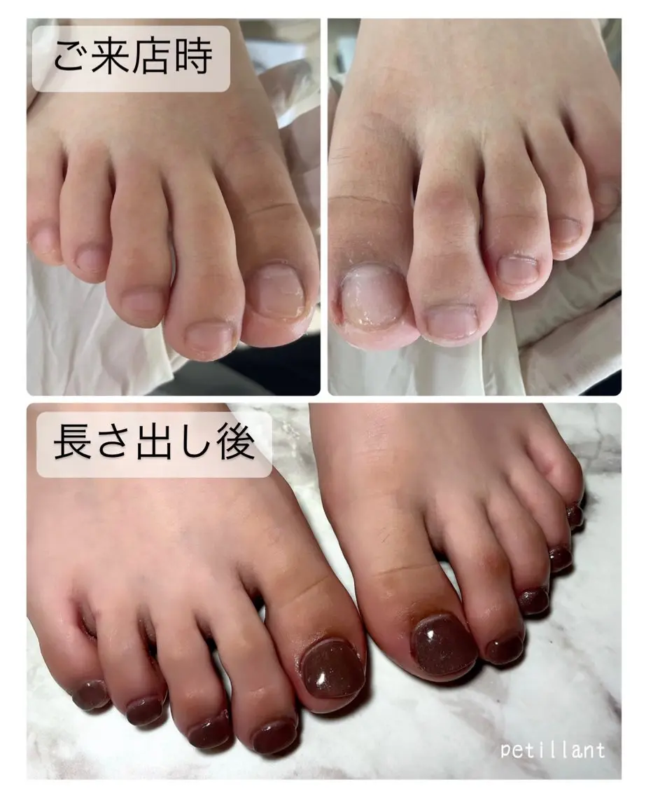 ネイル 長さ出し フットネイル nail salon petillantのネイルデザイン