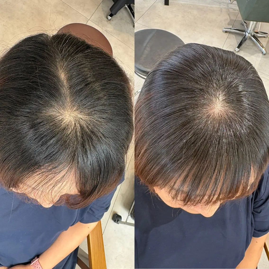 生えぐせ改善 黒木のヘアスタイル