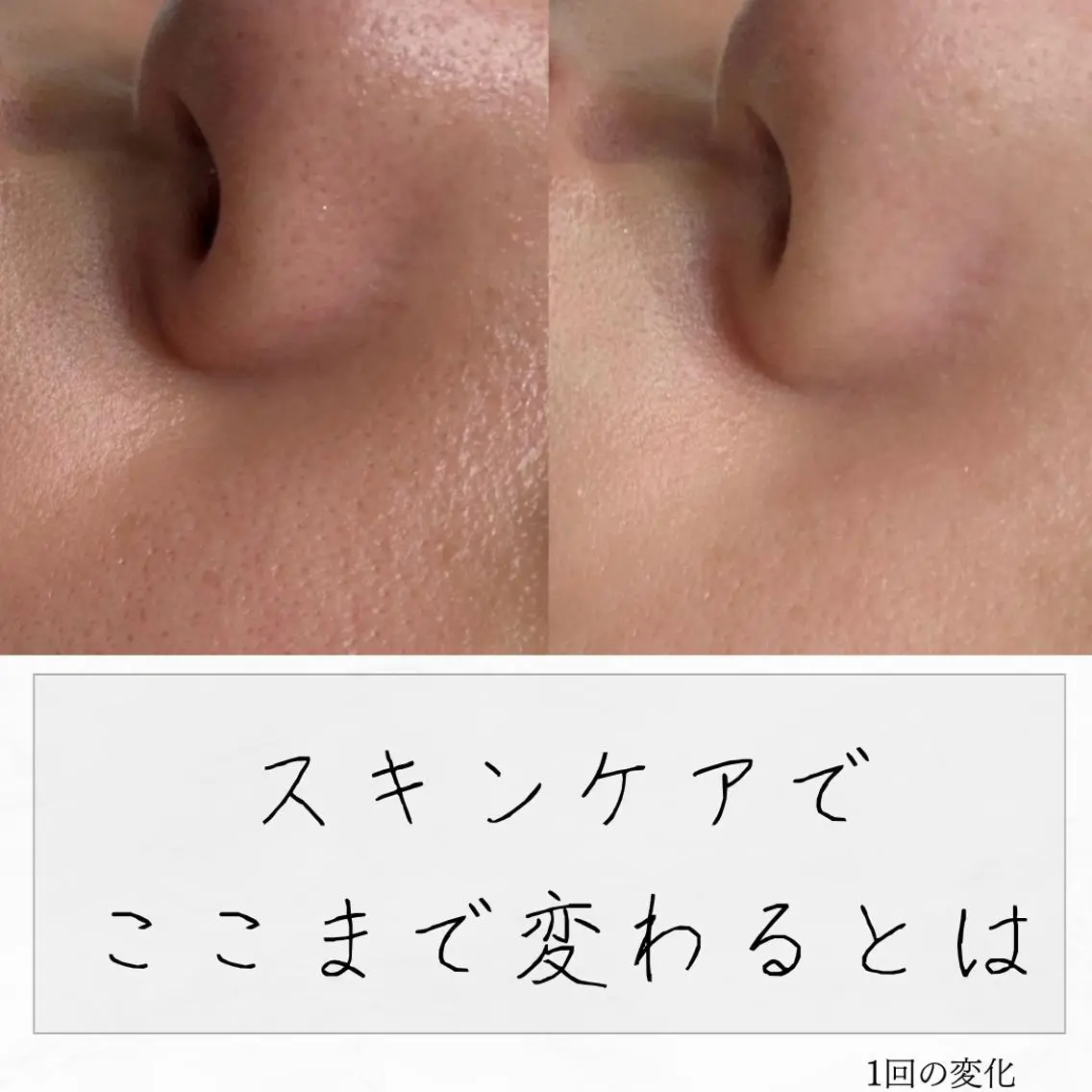 ニキビ経験者が施術 する専門サロン🌻のエステ・リラクイメージ