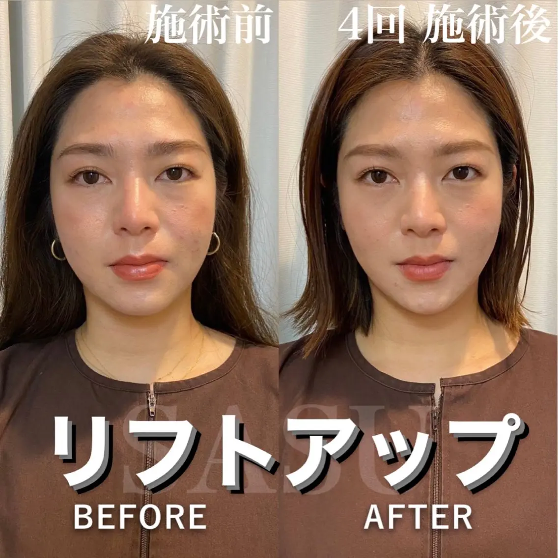 その他 石井 稚乃のその他イメージ