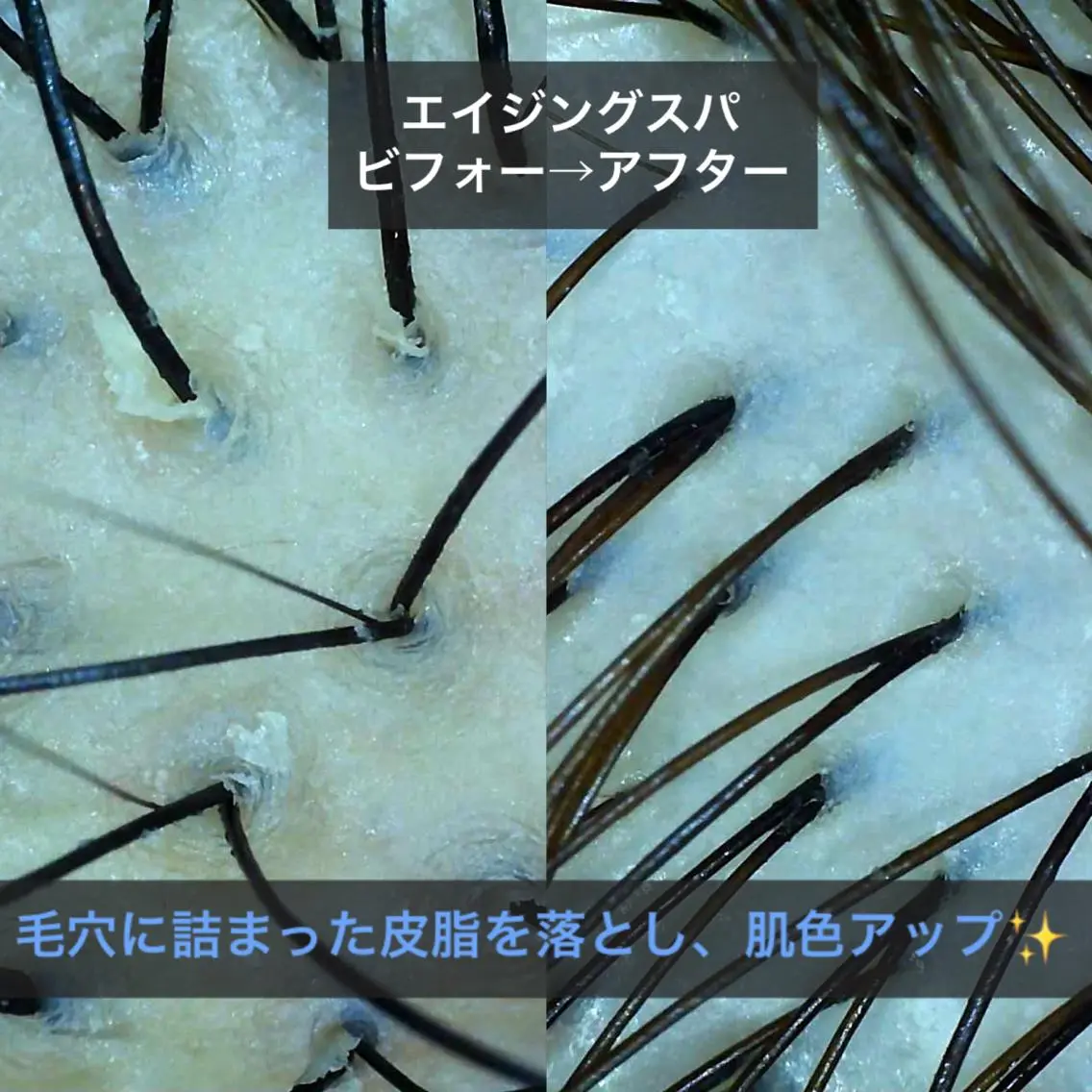 【リカバリーエステカットコース】カット+エイジングスパ+育毛ケア✨髪を作る細胞へ濃厚栄養成分を浸透させることでハリツヤ髪の写真
