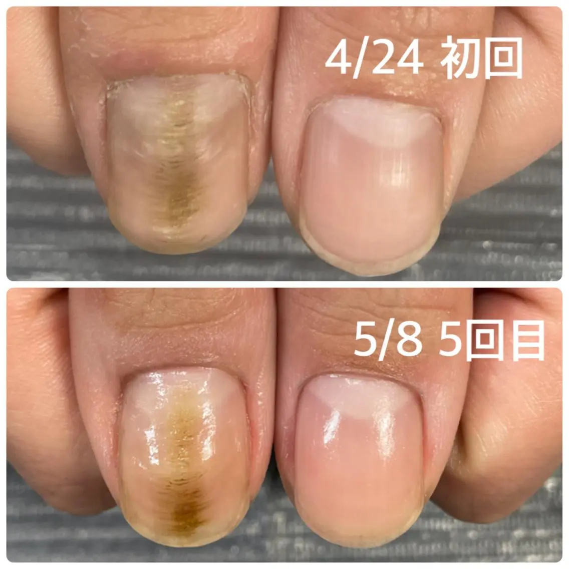 ネイル 奥園 良恵のネイルデザイン