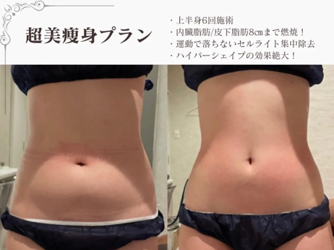 エステ リラク 総合美容サロン LOVEME渋谷本店のエステ・リラクイメージ