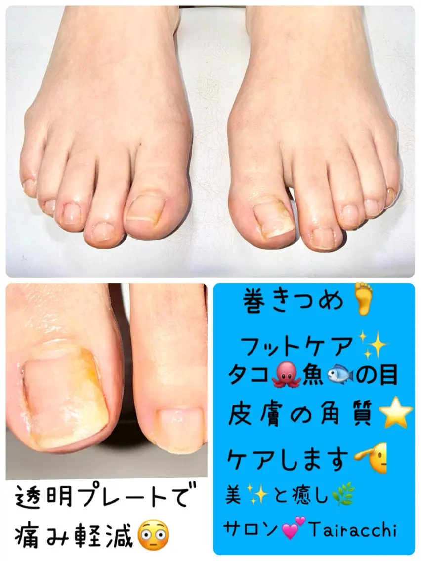 ネイル フットネイル フットネイル Tairacchi タイラッチのネイルデザイン