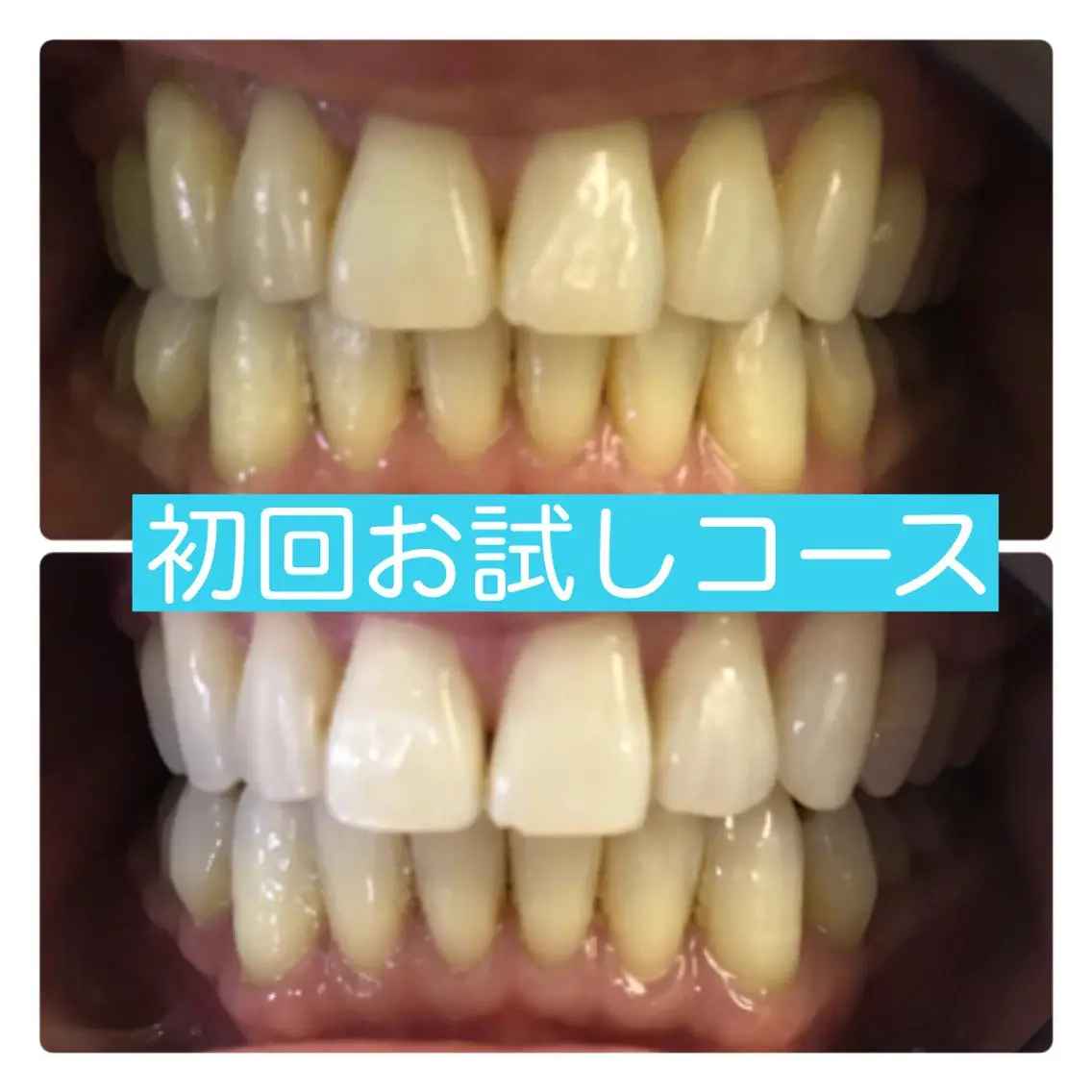 ホワイトニングルーム 横浜店のその他イメージ