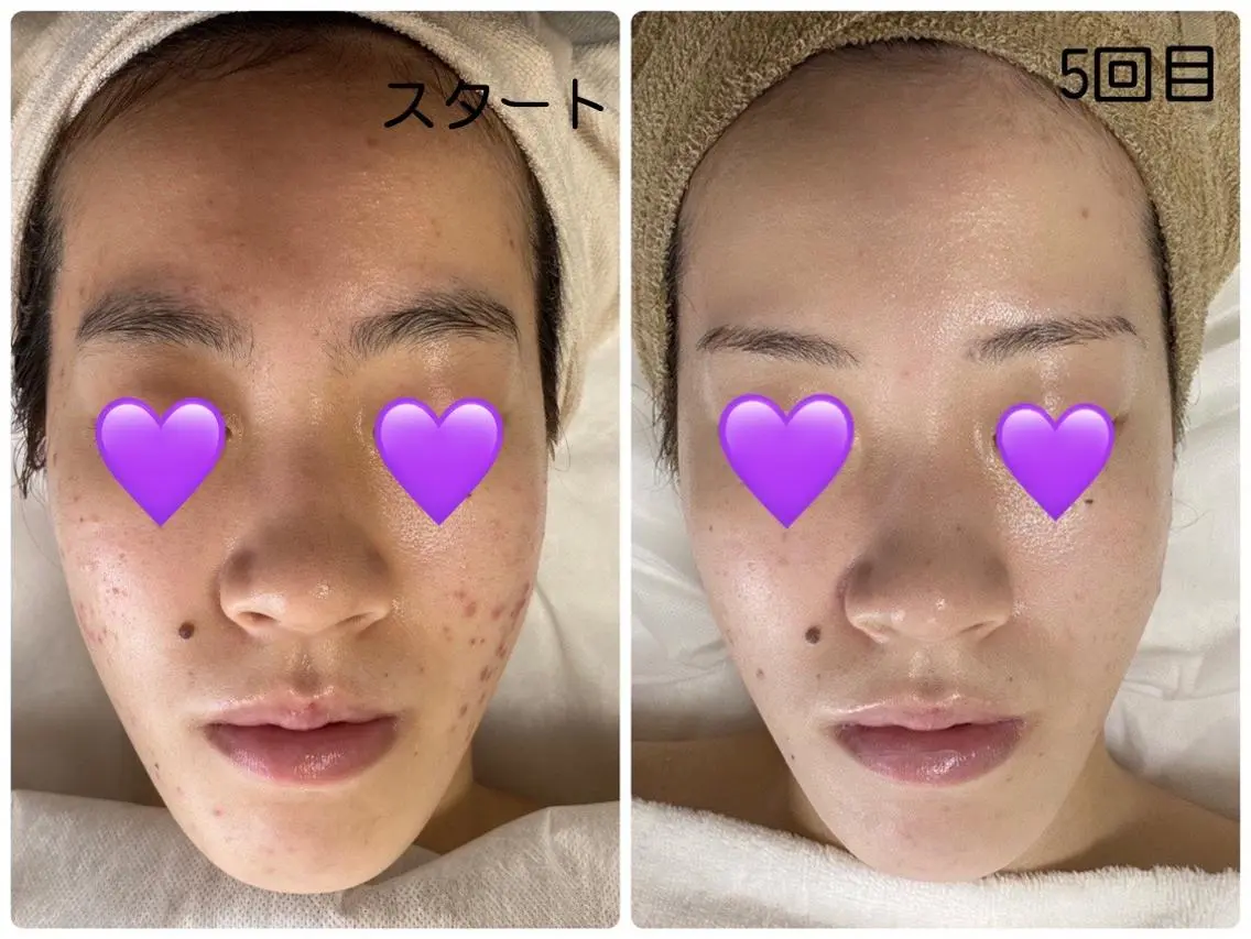 エステ COCO beautyサロンのエステ・リラクイメージ
