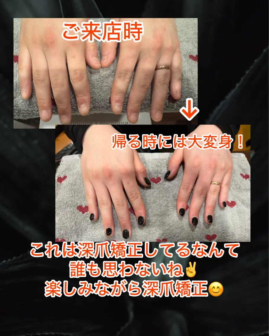 ネイル 毛穴肌質改善専門店 アンドトロワのヘアスタイル