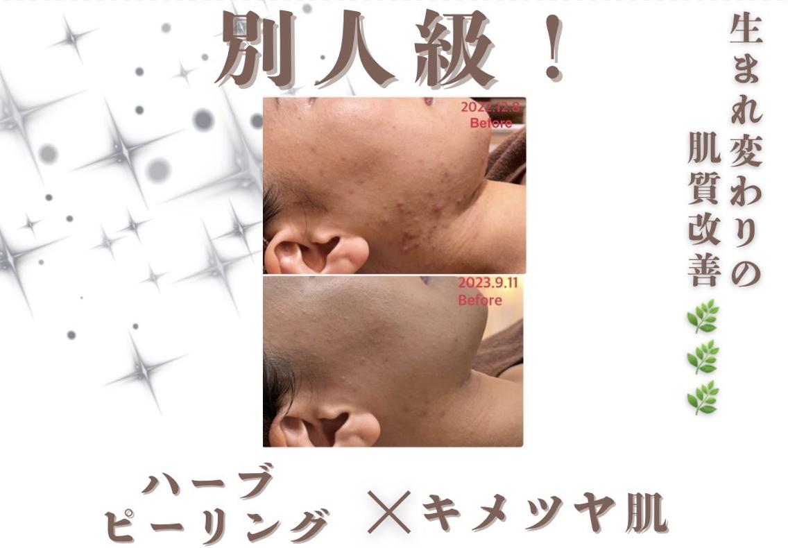 エステ 🫧美肌サロン🫧 レイビスひかる🧡のエステ・リラクイメージ