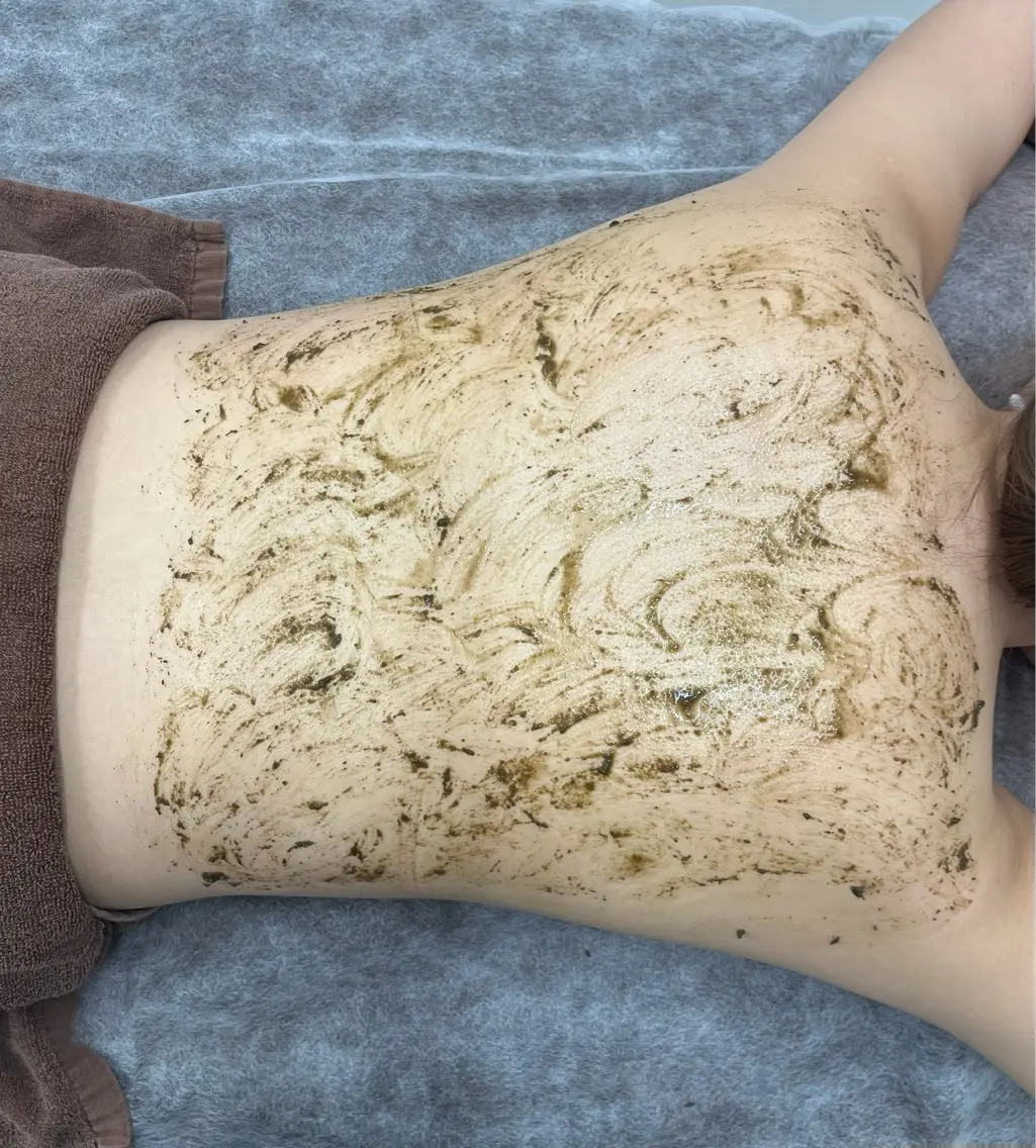 🌿背中上ハーブピーリング🌿剥離なし初回¥10000の写真