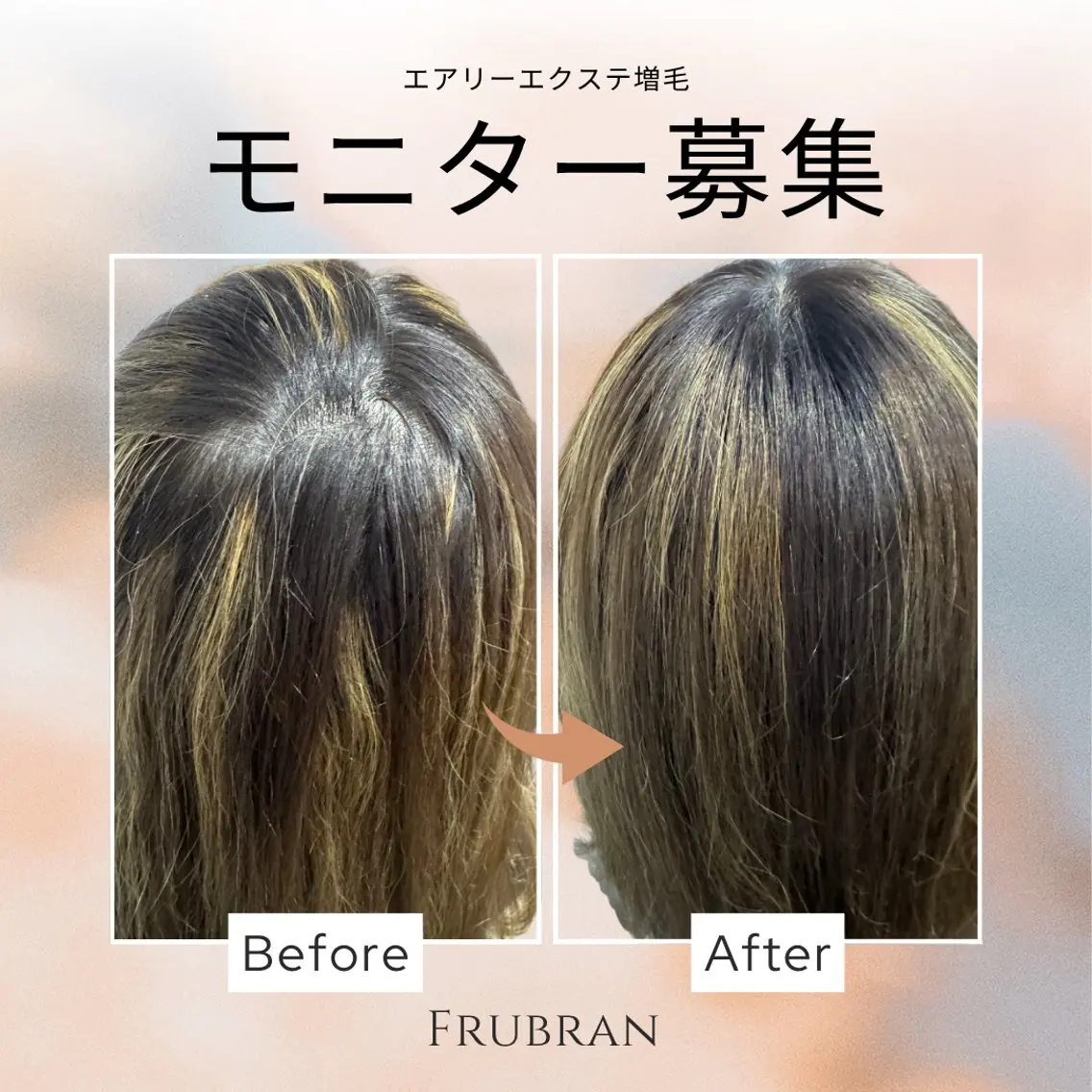 Frubran フルーブランのエステ・リラクイメージ