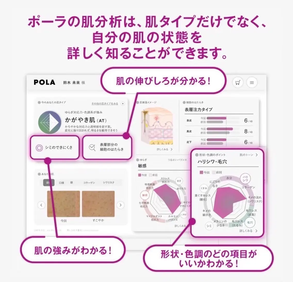 POLAのお肌分析✨お肌悩みの原因やケア方法を一緒に見てみませんか?の写真