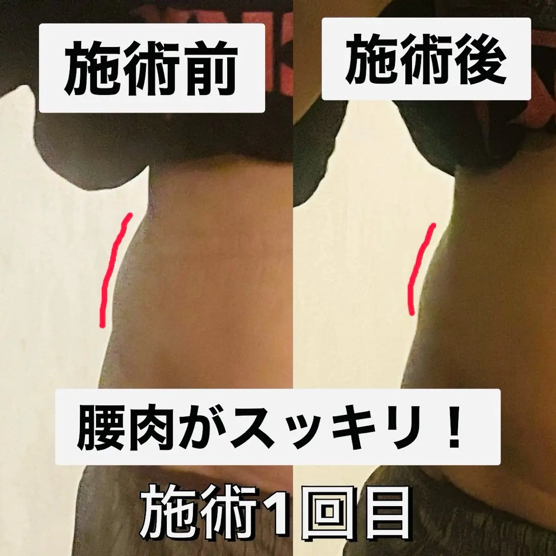 イナンナ⌇﻿腸もみ/ カッピング/痩身のエステ・リラクイメージ