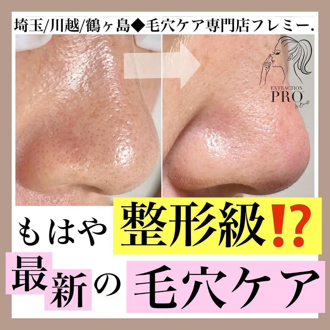 本気の毛穴改善Bコース(デコルテマッサージ付) ※毛穴エクストラクション プロの写真