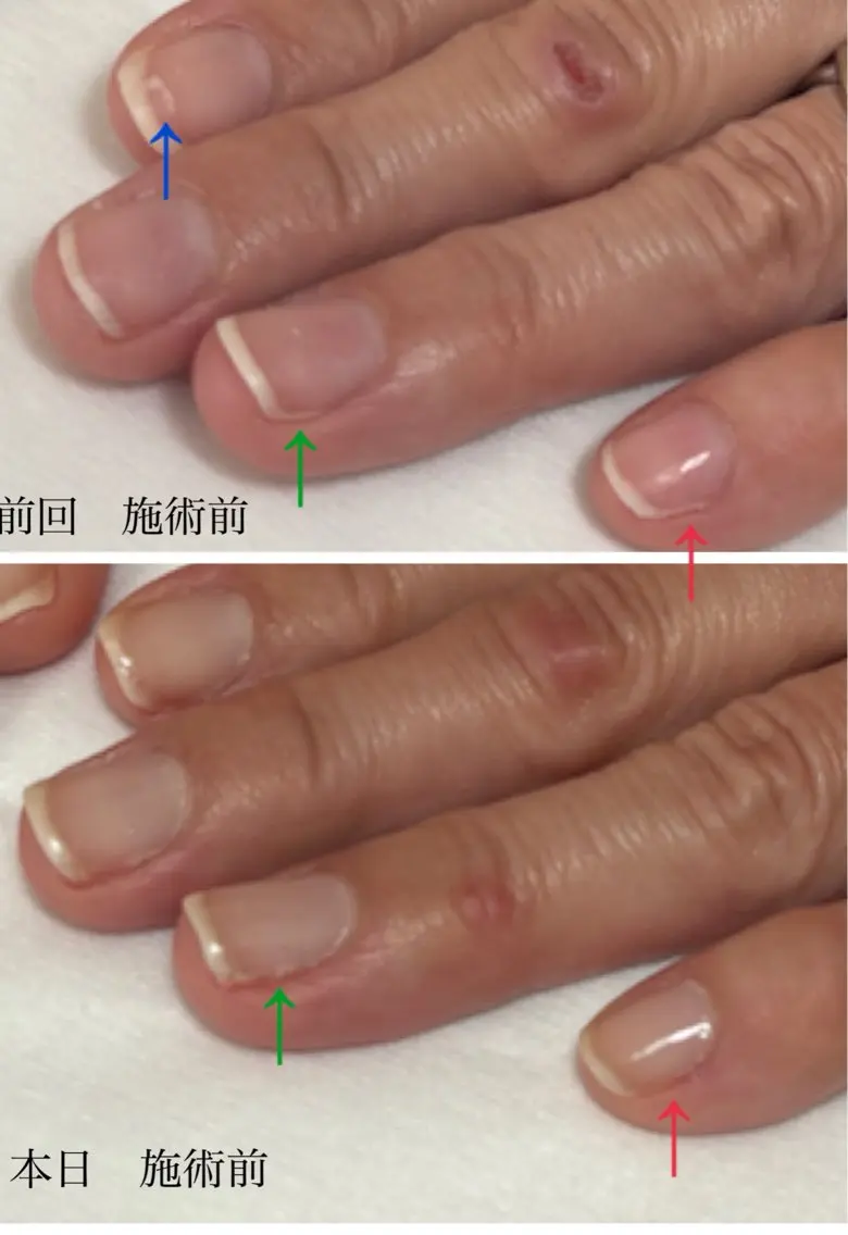 ネイル ジェルネイル Alo.nail アロ•ネイルのネイルデザイン