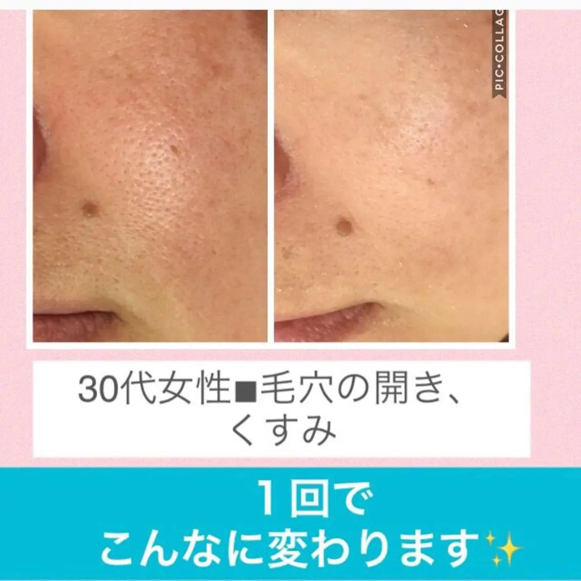 ミディアム カラー パーマ ヘアアレンジ メンズ キッズ ネイル マツエク・マツパ ニキビ・肌質改善専門 ♡人生が変わるサロンのエステ・リラクイメージ