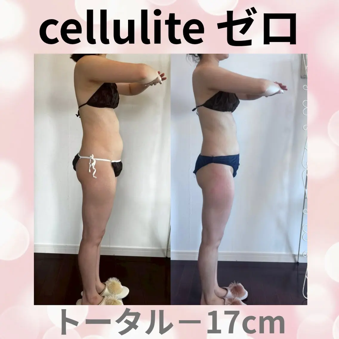 エステ beauty SalonRcoinのマツエク・マツパデザイン