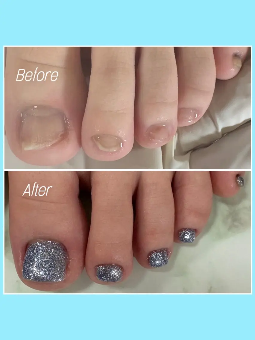 ネイル 長さ出し フラッシュネイル キラキラネイル ラメ(グリッター) フットネイル nail salon petillantのネイルデザイン
