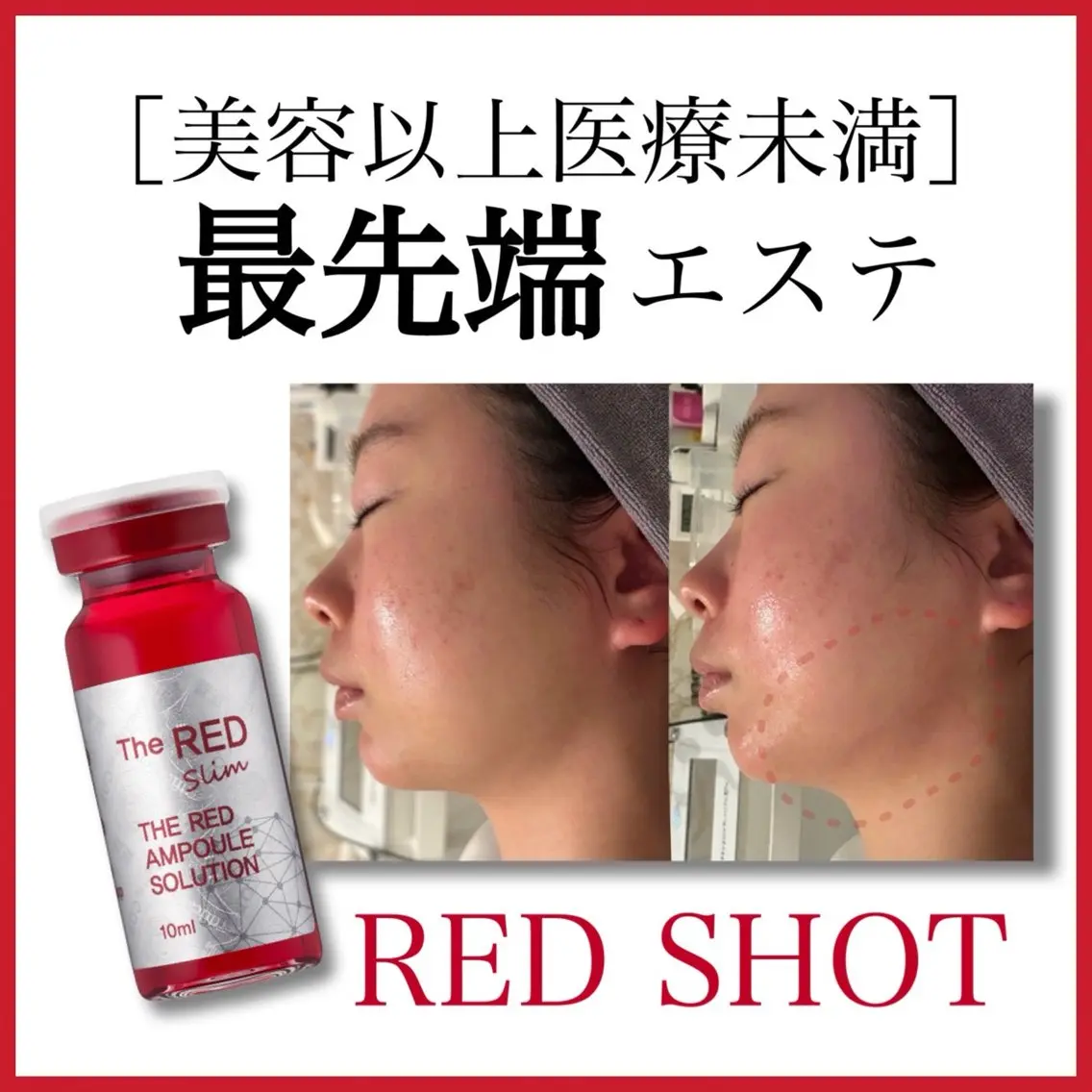 レッドショット2cc🍍¥10000の写真