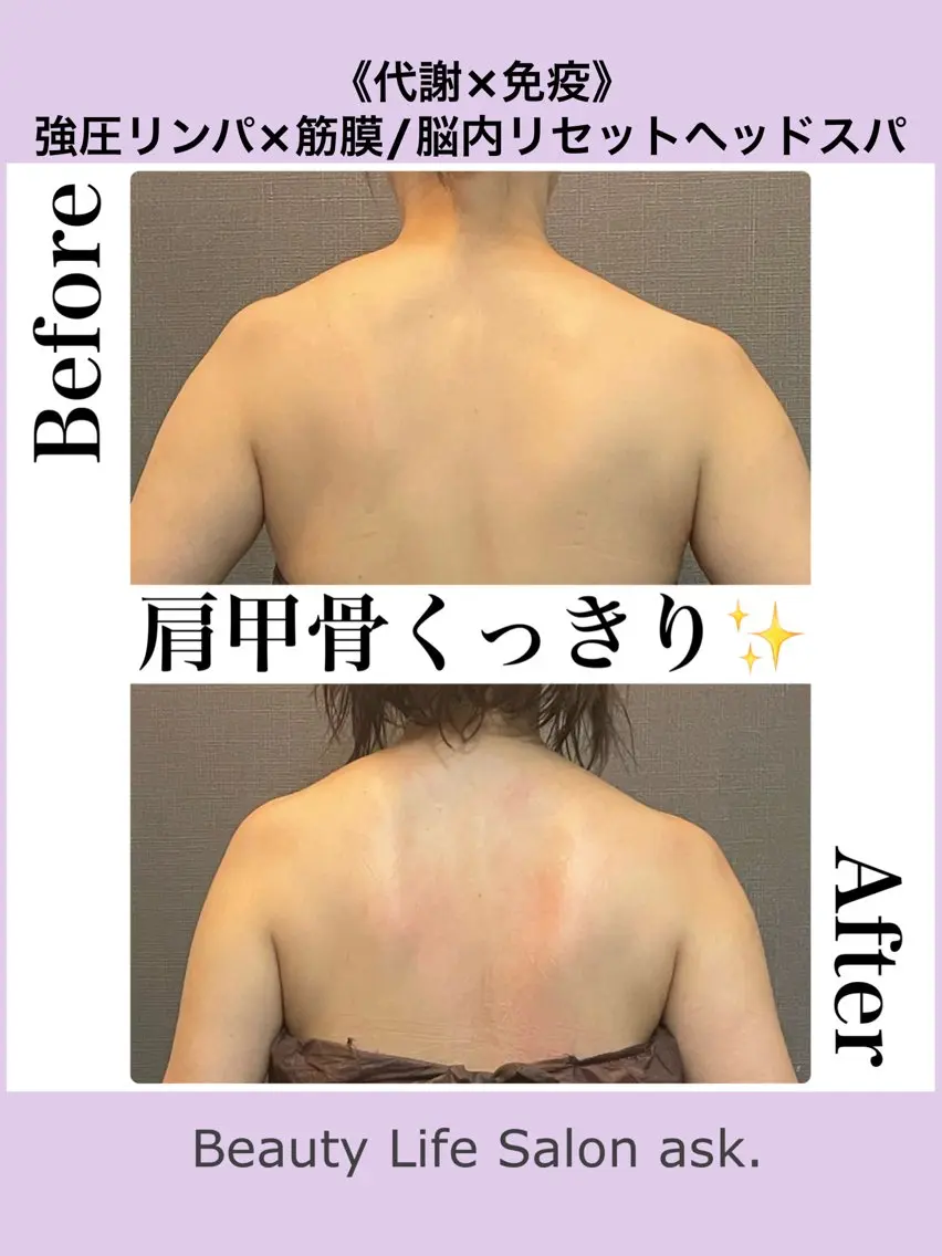 エステ 深層筋×筋膜リリース 首肩こり/むくみのエステ・リラクイメージ