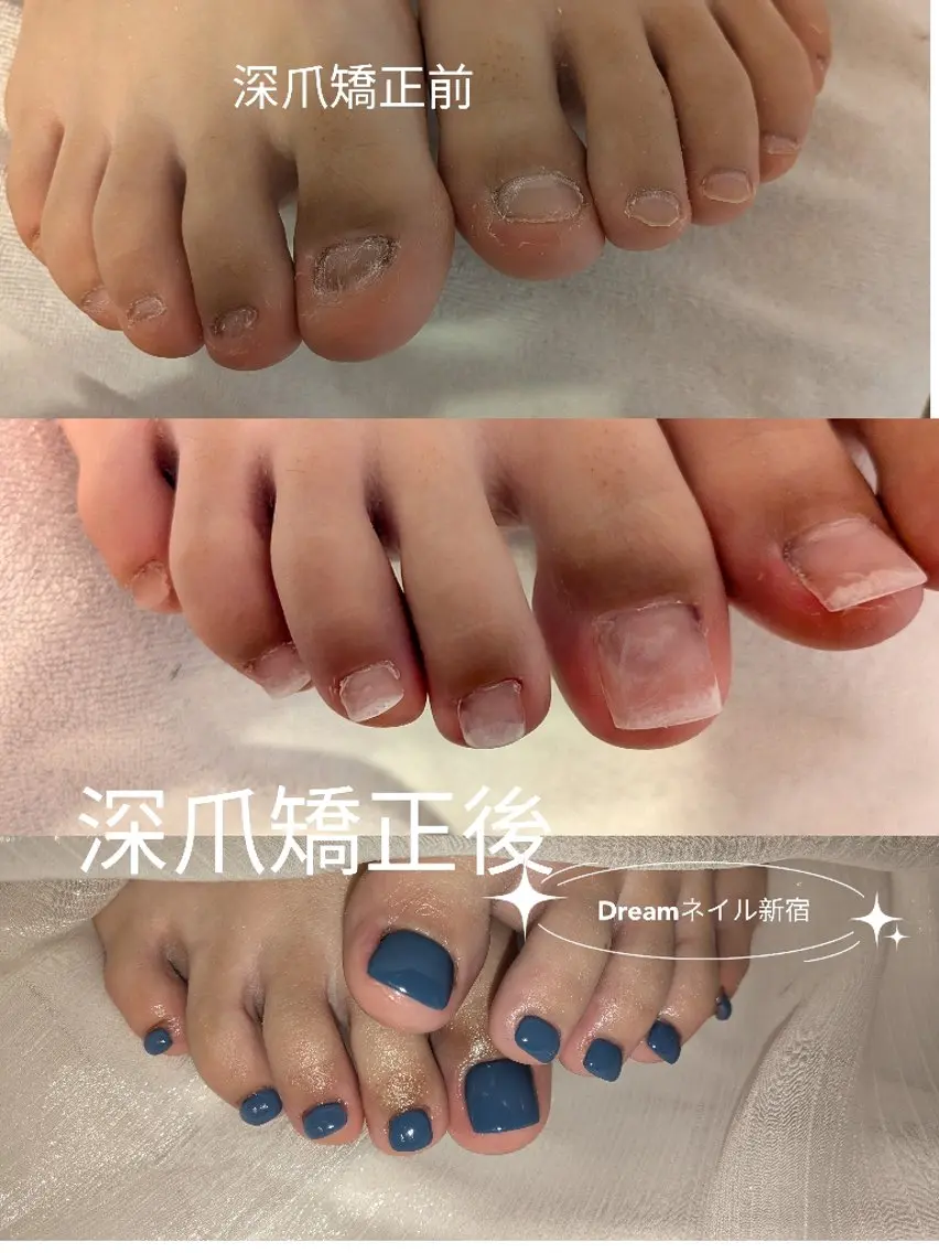 ネイル フットネイル フットネイル ネイリスト ゆかのネイルデザイン