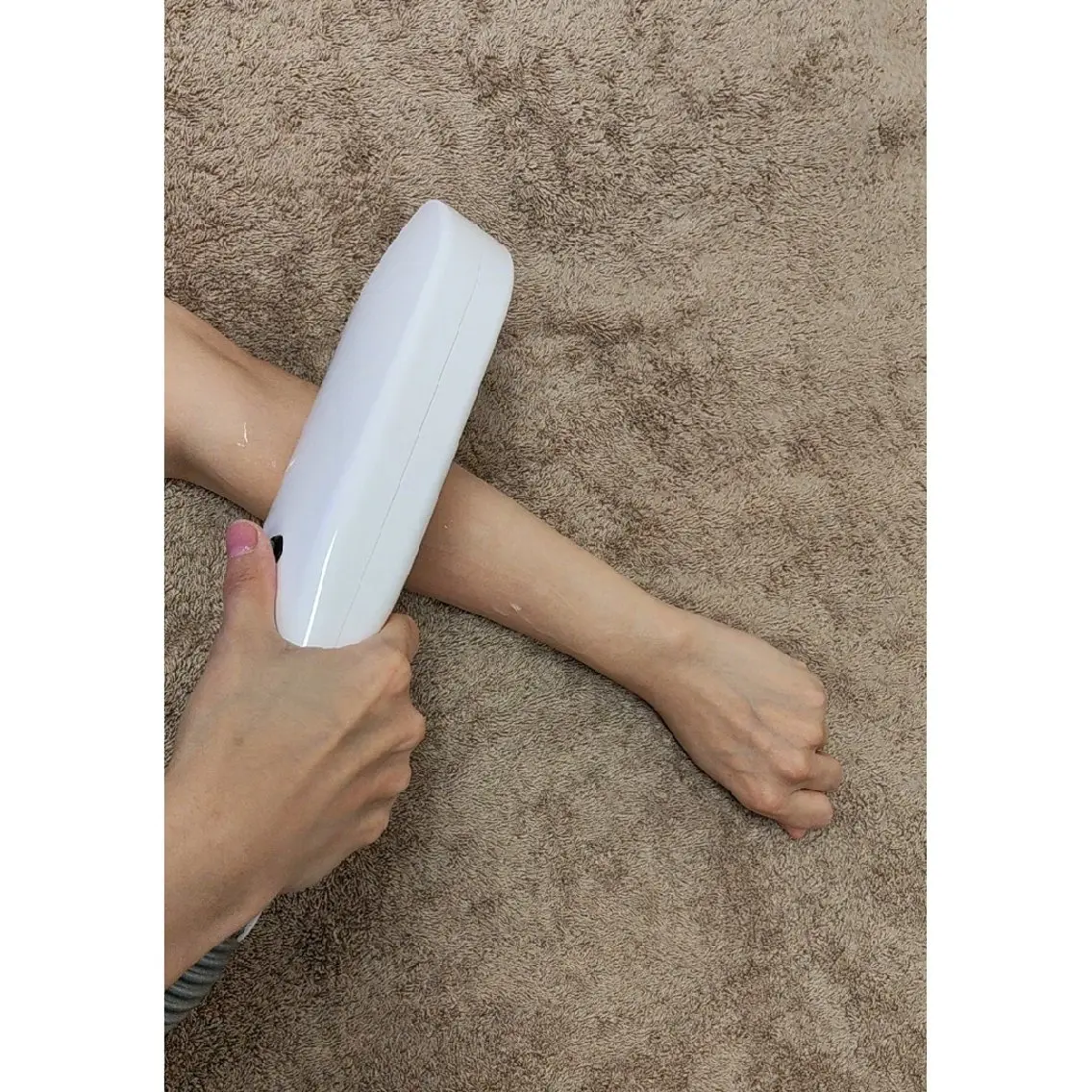 IVO脱毛の写真