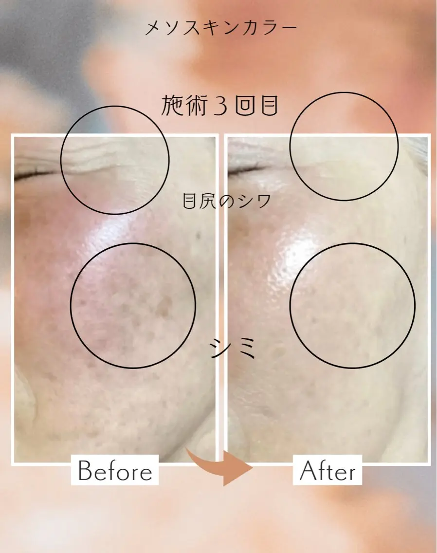 エステ リラク 毛穴・肌質改善サロン réposのその他イメージ