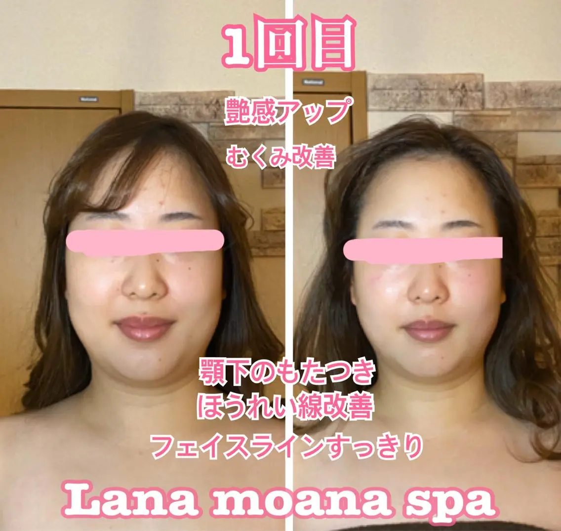 本気で追求！人気No.1🧡結果重視✨骨格にあった小顔と美肌になりたい方におすすめ！！の写真
