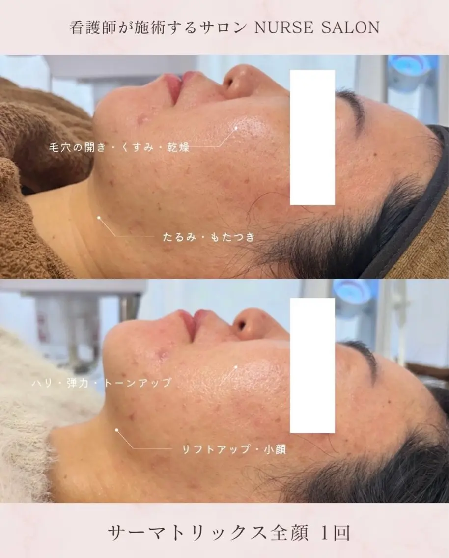看護師が施術する美容 ナスサロ/mitoのエステ・リラクイメージ