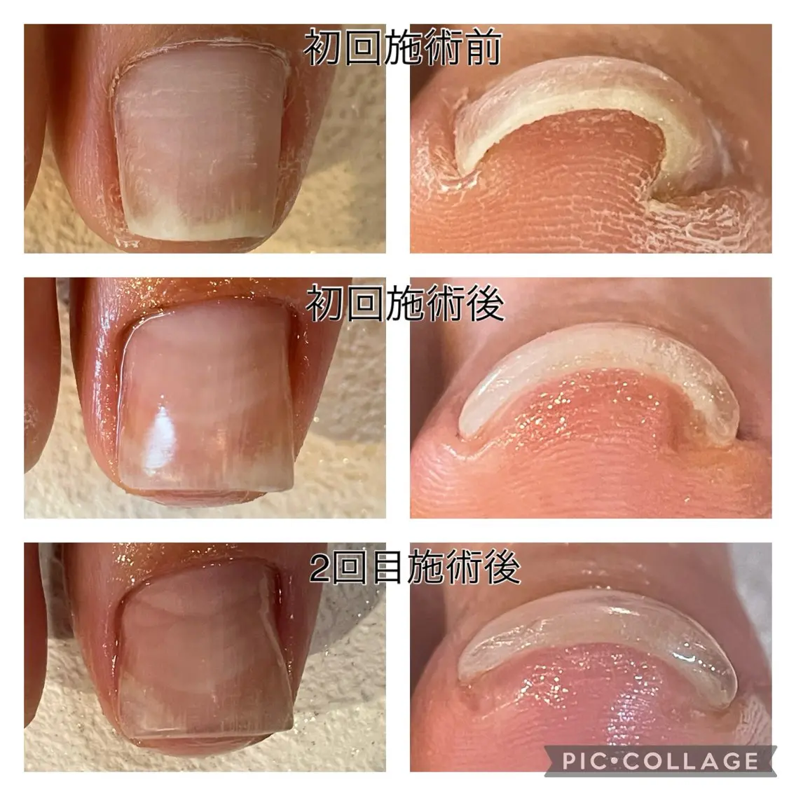 gorella Ａのネイルデザイン