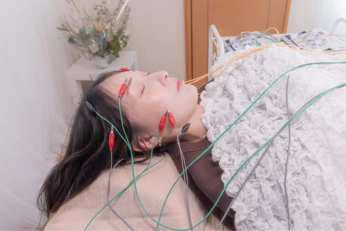 眼精疲労噛み締め頭痛表情が作りにくい方お顔のむくみが気になる方筋肉の老化を遅らせたい方におすすめ美容鍼🌷の写真
