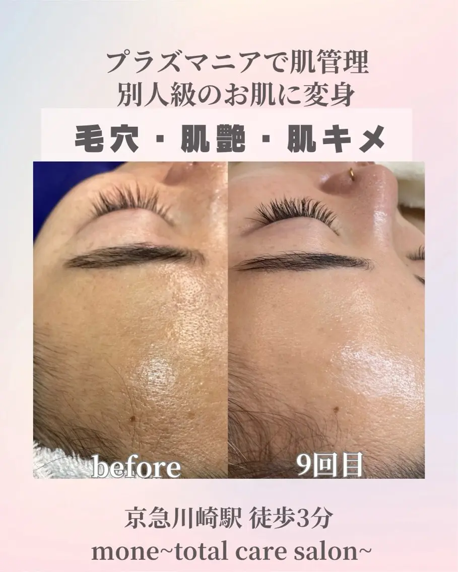 エステ mone (モーネ)のエステ・リラクイメージ