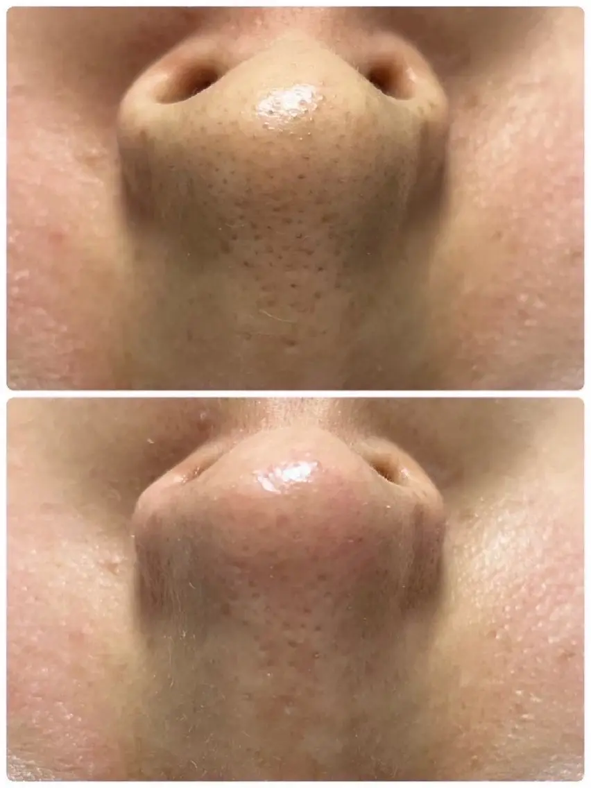 エステ TLIENGLE高宮 エステ・ネイルのエステ・リラクイメージ