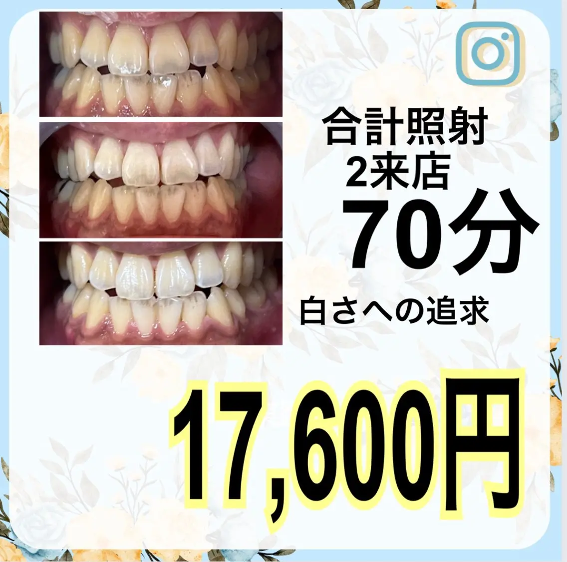 その他 ライトビューティー 渋谷本店のその他イメージ