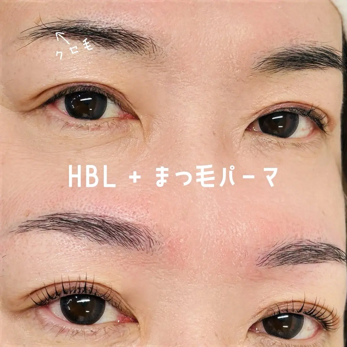 HBLの写真