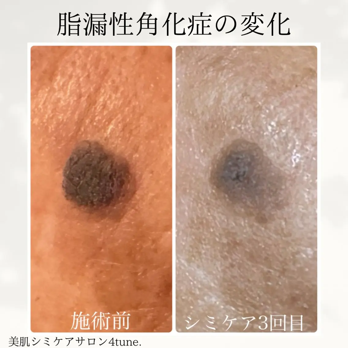 美肌シミケアサロン 4tune.RUMIのその他イメージ