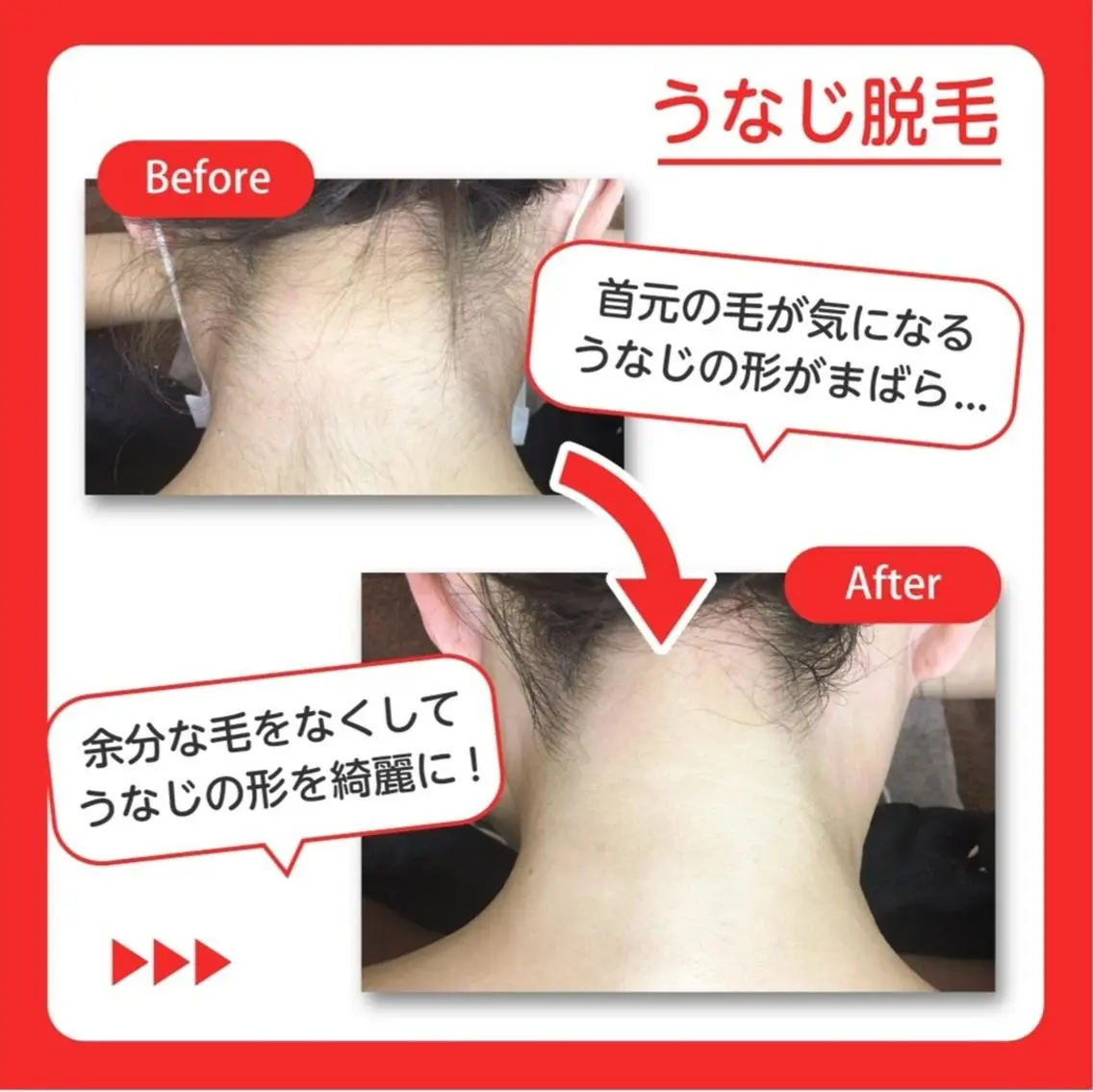 RinRin 松山店のエステ・リラクイメージ