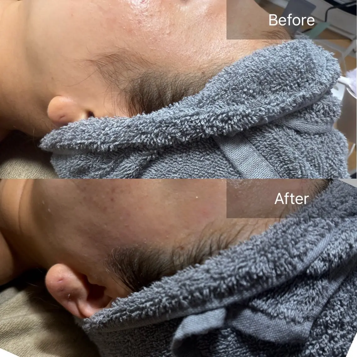 脱毛 enine フェイスWAXのエステ・リラクイメージ
