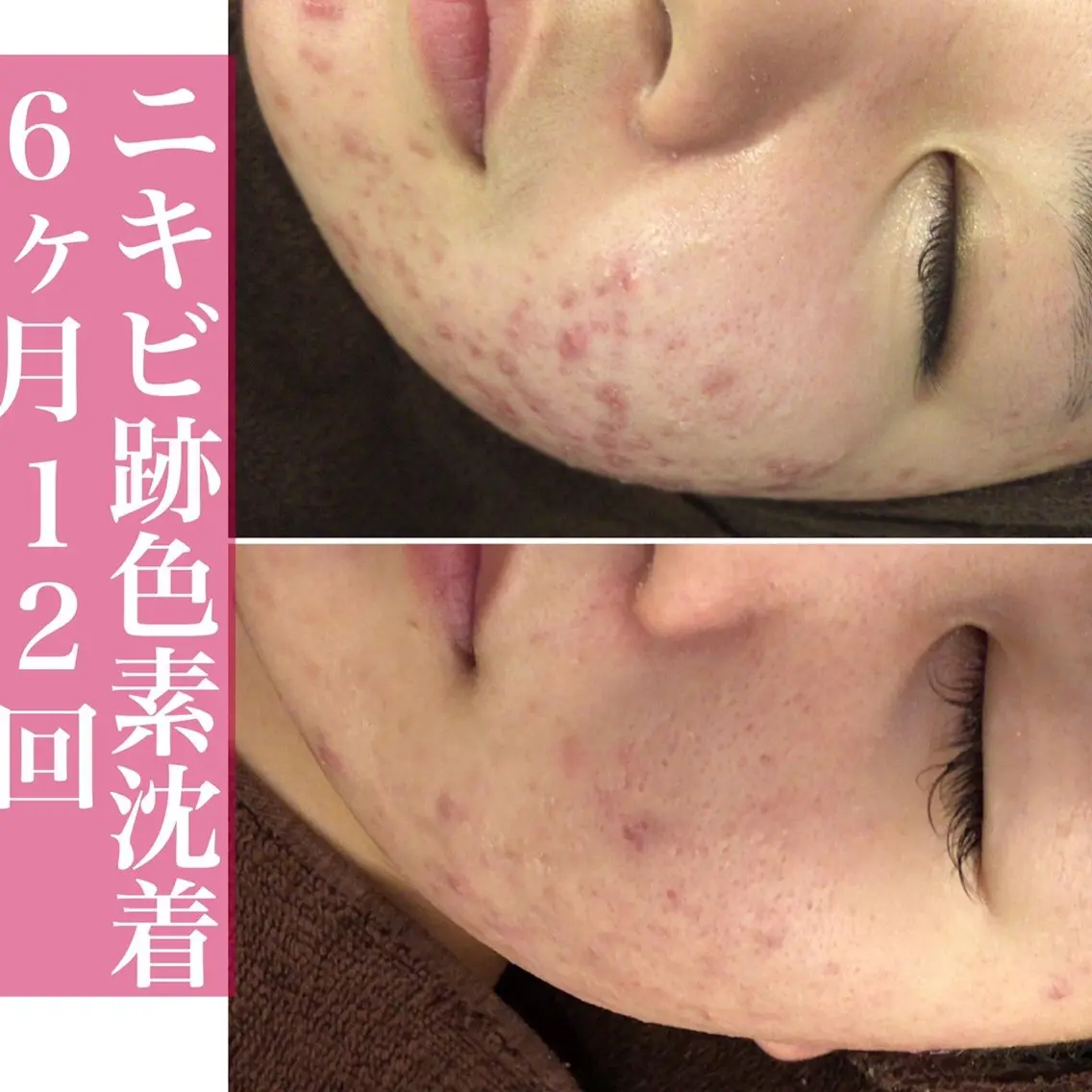 エステ リラク ニキビ・肌質改善専門 ♡人生が変わるサロンのエステ・リラクイメージ