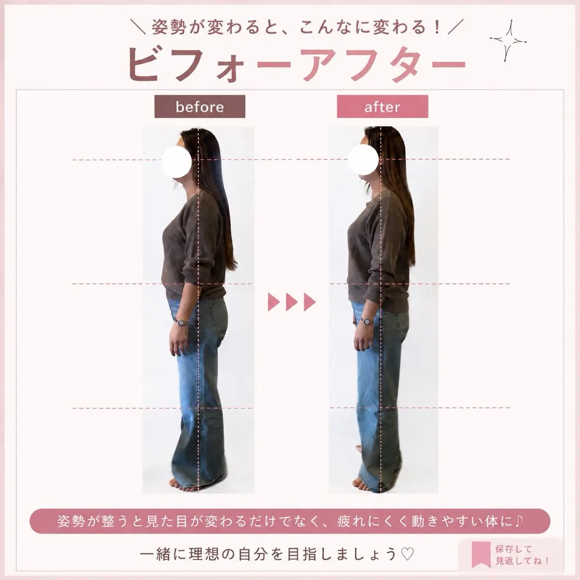 【お試し】姿勢チェック＋骨盤調整（30分）の写真