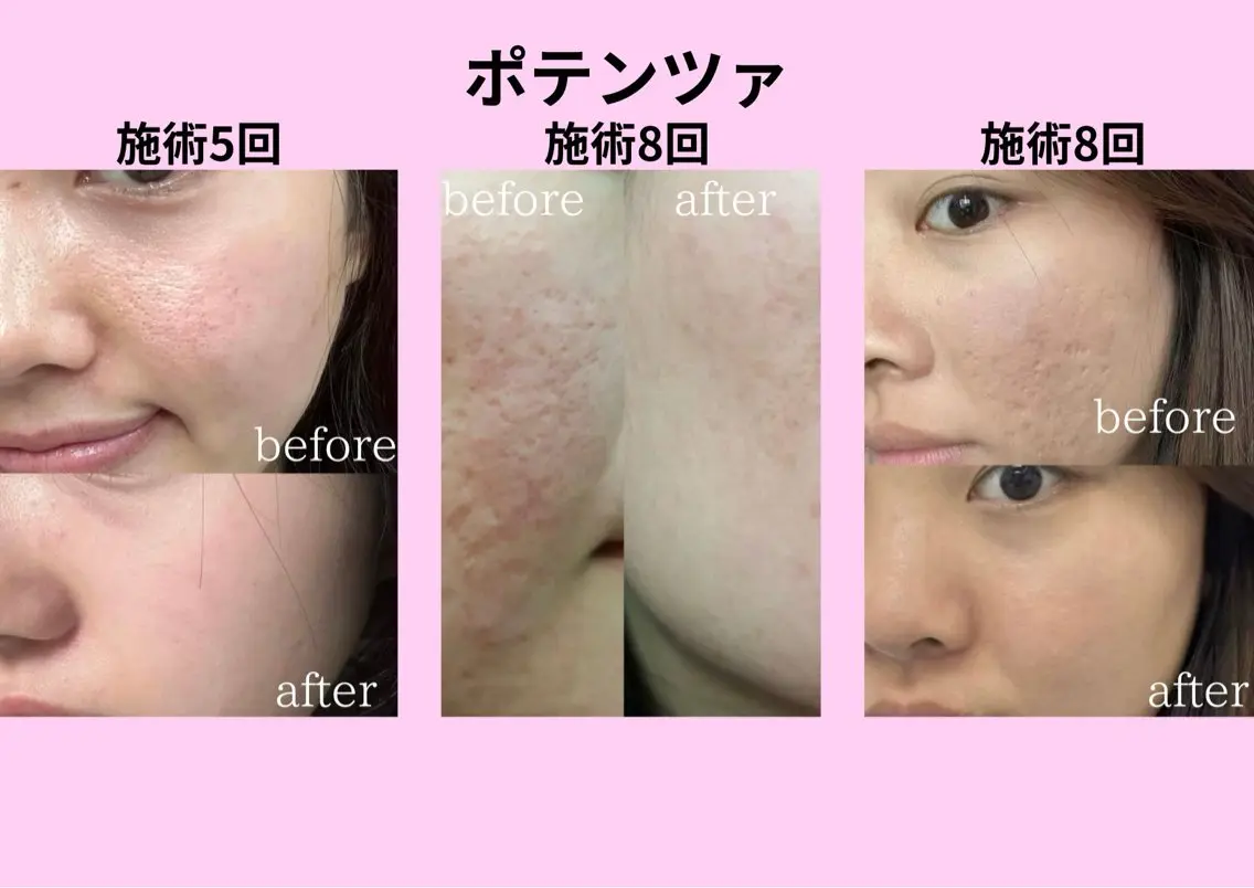 ネイル エステ 愛維美水光美肌専門店 メンズレディースokのエステ・リラクイメージ