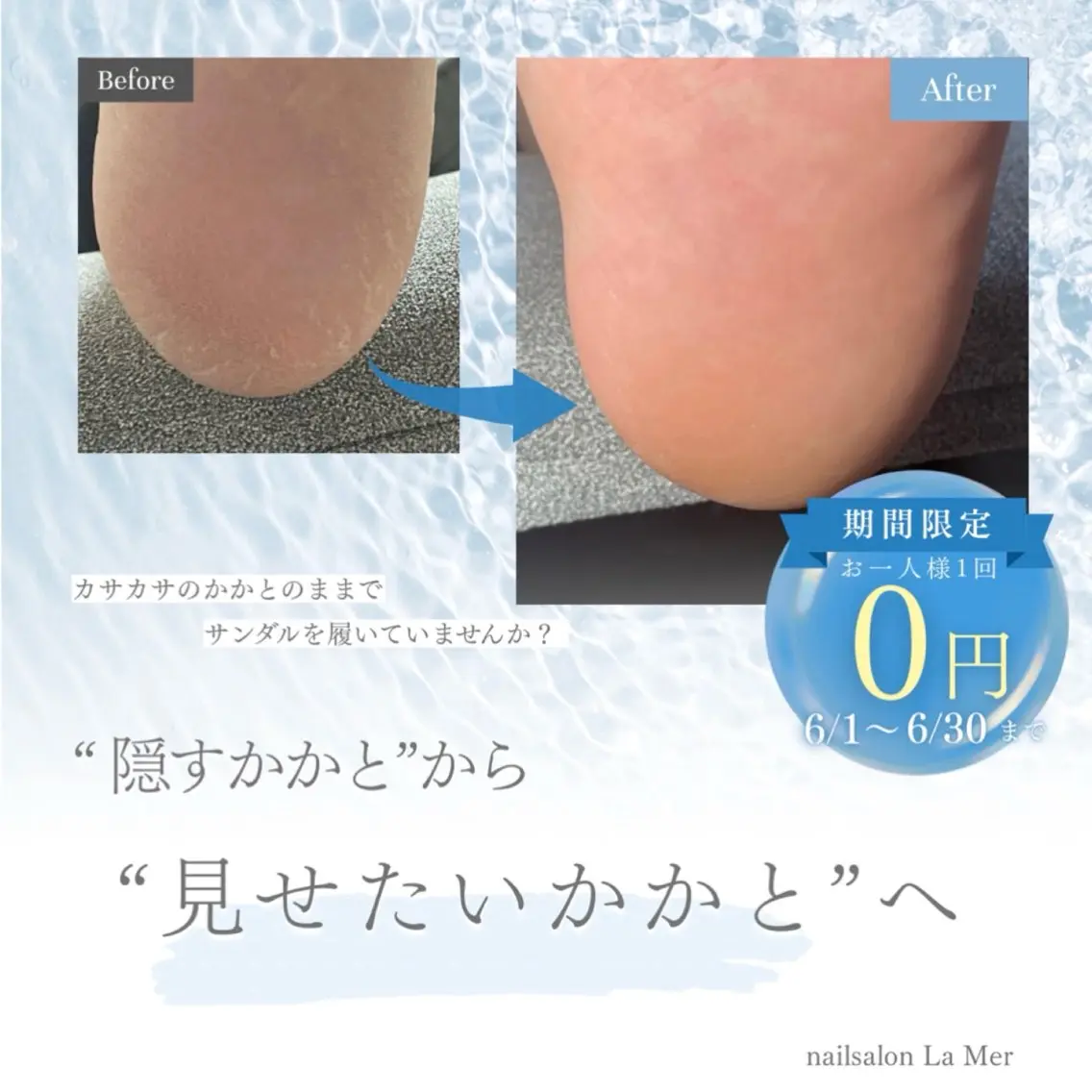 ✨足裏ケア無料✨【オフ込み】マグネット／フットの写真