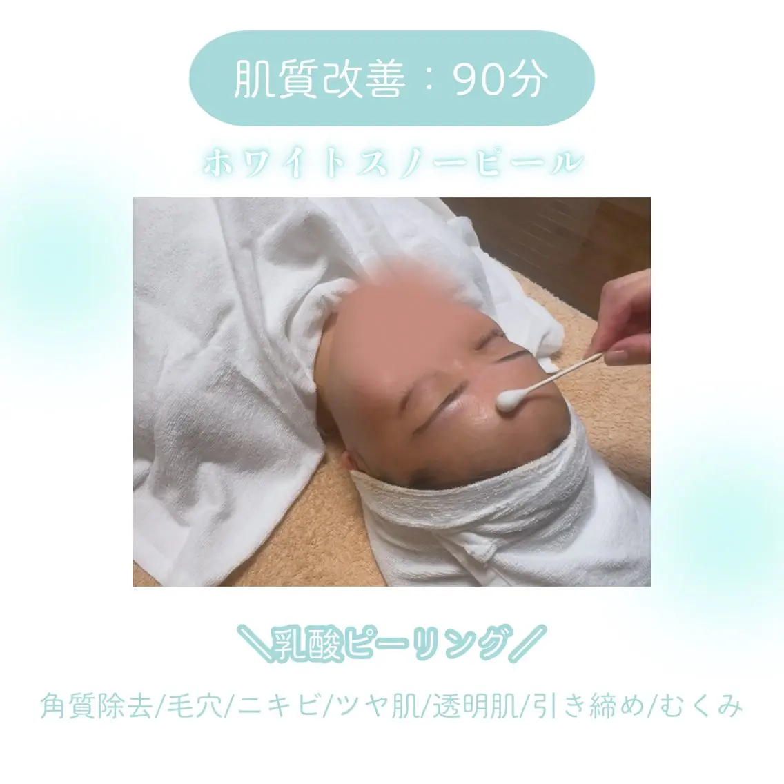 【肌質改善】毛穴づまり×ニキビ肌に！角質除去ピーリング：初回90分¥11,000の写真