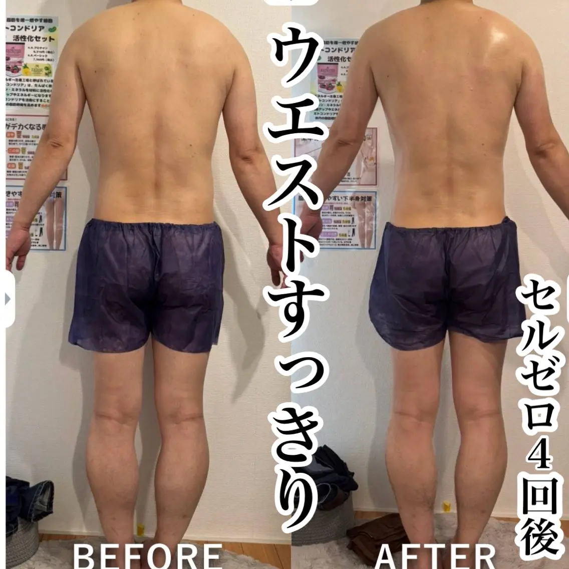 ★二の腕、背中、腰回り★上半身セルゼロ痩身の写真